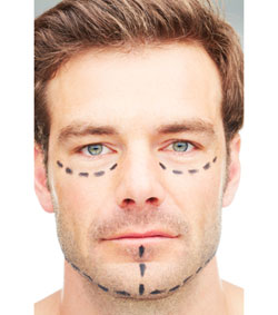 Male Breast Reduction (Gynecomastia Surgery) in Savannah, GA