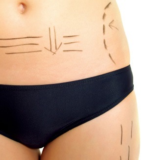 Plastic Surgery in Savannah, GA