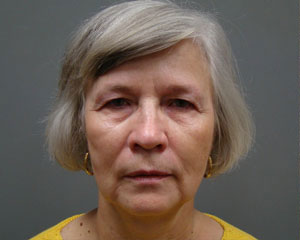 Eyelid Surgery Before and After Pictures Savannah, GA