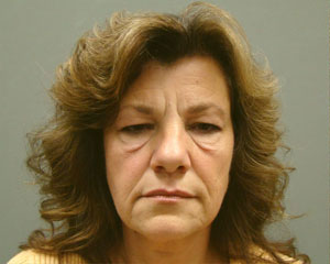 Eyelid Surgery Before and After Pictures Savannah, GA