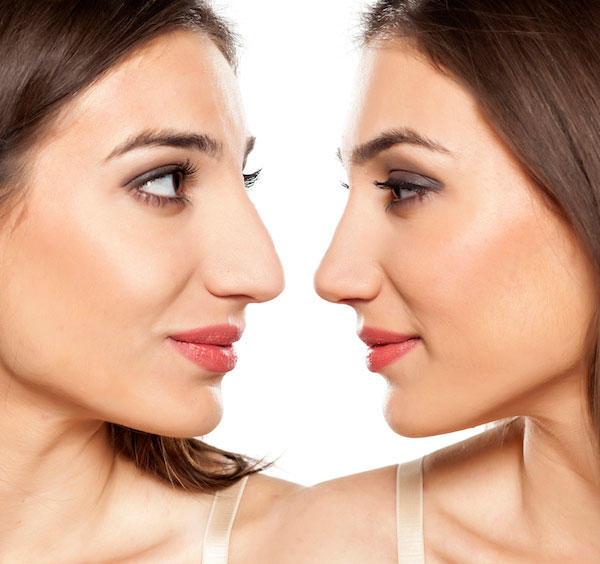 The Right Nose for Each Face Savannah Plastic Surgery