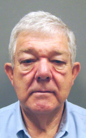 Eyelid Surgery Before and After Pictures Savannah, GA